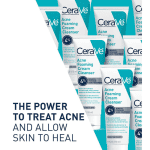 Cerave Acne Foaming Cream Cleanser