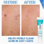 Cerave Acne Control Gel