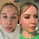 The INKEY List Tranexamic Acid Night Treatment