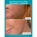 Paula's Choice Exfoliate